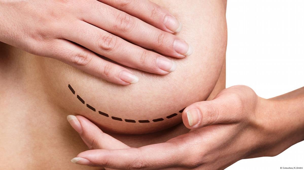 Mulher viraliza ao acordar após procedimento cirúrgico!