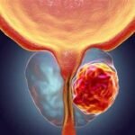 Morando de Favor! A trajetória de Manoel Gomes e os desafios após a fama!